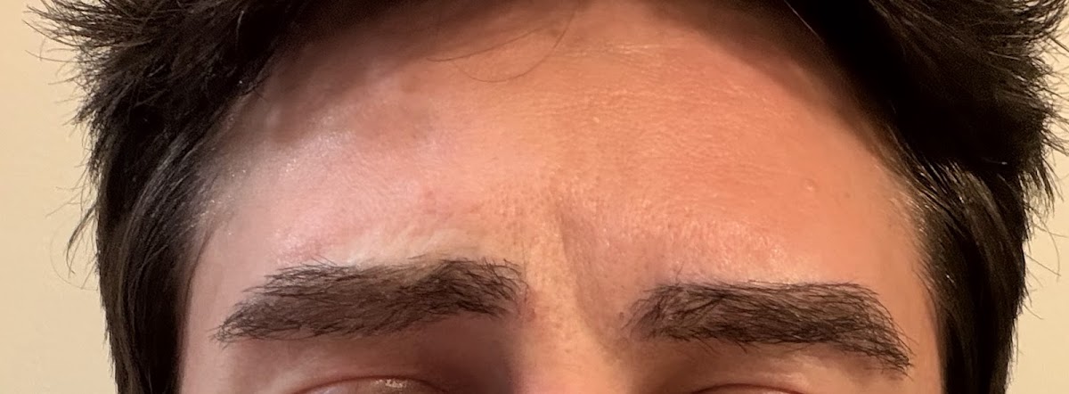 Unfiltered Medical Aesthetics LLC — photo 2