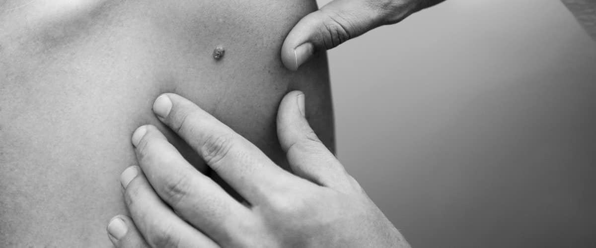 Absolute Dermatology & Skin Cancer Center in Richmond, Virginia
