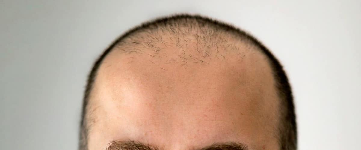 Adnan Prsic, MD in New Haven, Connecticut