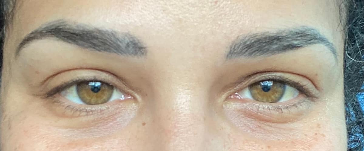 Advanced Aesthetics in Medford, Oregon