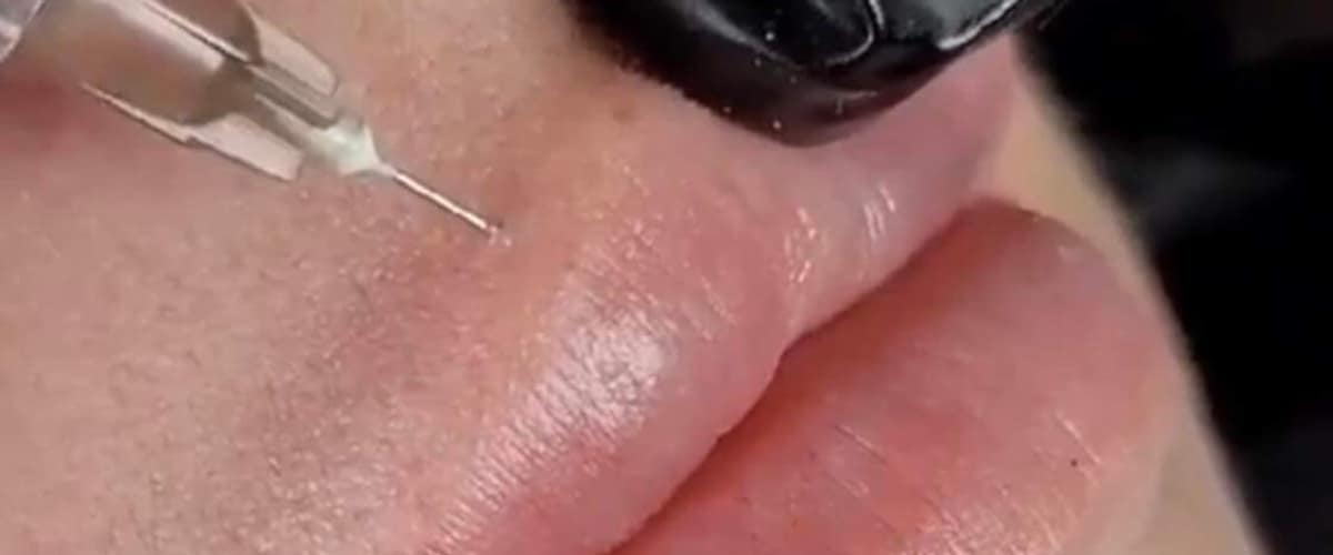 AGS Cosmetic Injections “Ms. Botox of Idaho” in Idaho Falls, Idaho