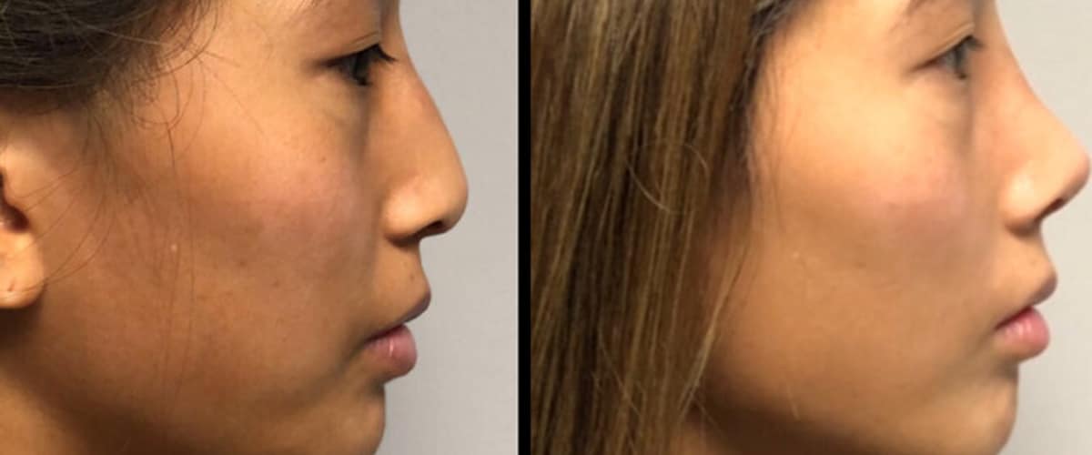 Back Bay Plastic Surgery in Boston, Massachusetts