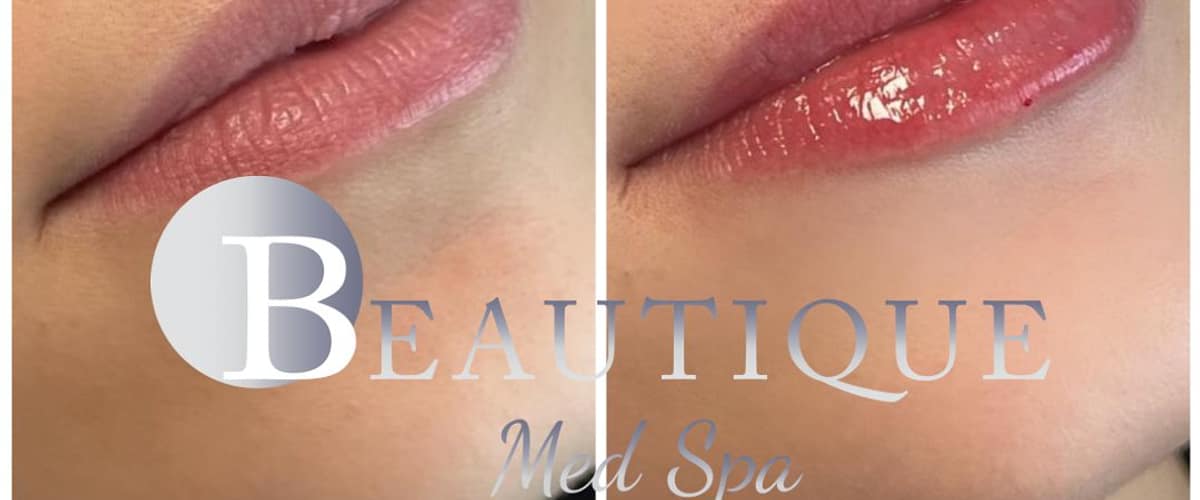 Beautique Med Spa Barrie in Barrie, Ontario