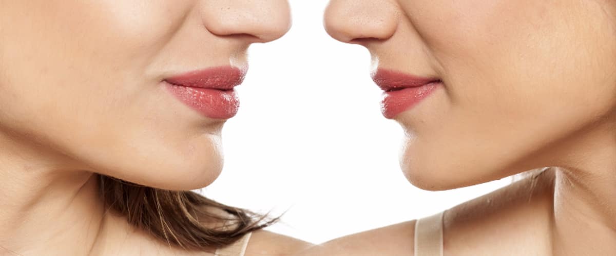 East Bay Plastic & Reconstructive Surgery in Oakland, California