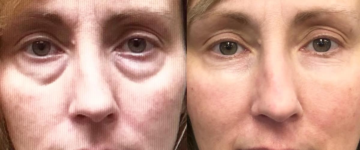 Form Medical Aesthetics in Winnipeg, Manitoba