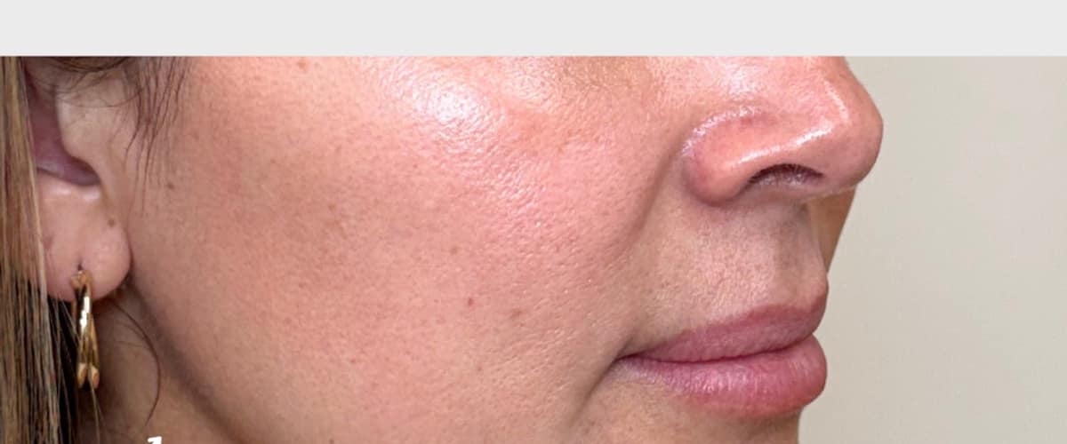 Franco Wellness & Aesthetics - Yuma AZ in Yuma, Arizona