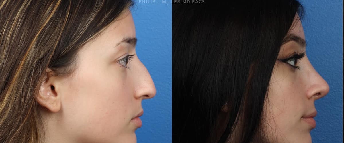 Gotham Plastic Surgery in Manhattan, New York