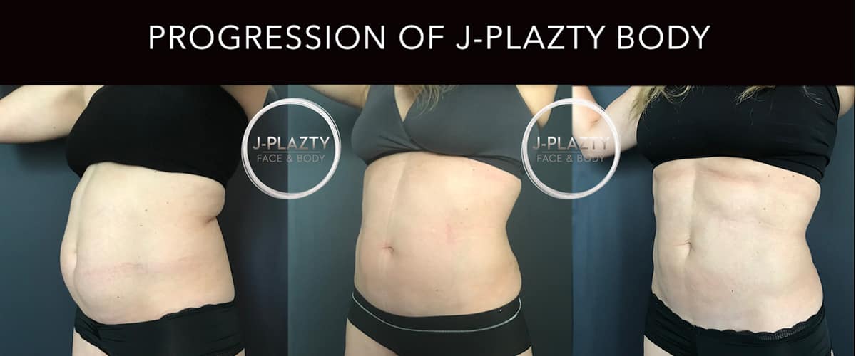 Jack Zamora MD Cosmetic Surgery and Aesthetics in Cherry Creek, Colorado