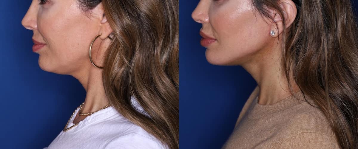 Kalos Facial Plastic Surgery LLC in Buckhead, Georgia