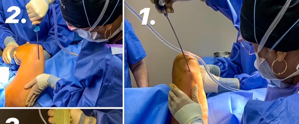 Khan Plastic Surgery in Dallas, Texas
