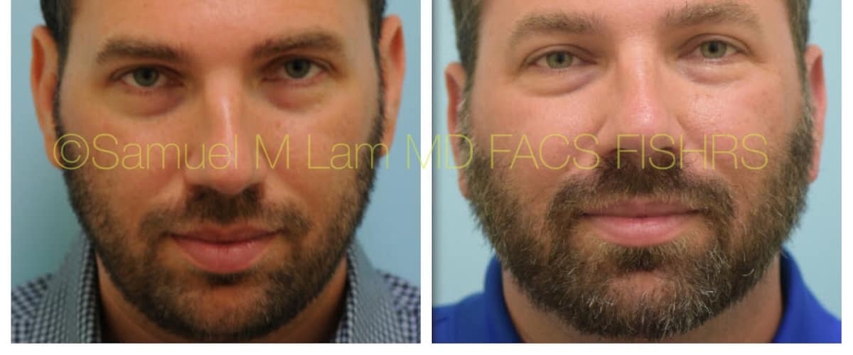 Lam Facial Plastics - Samuel M. Lam, MD, FACS in Plano, Texas