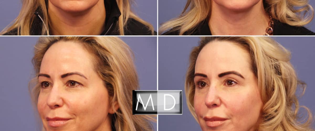 Lemmon Avenue Plastic Surgery and Laser Center in Dallas, Texas