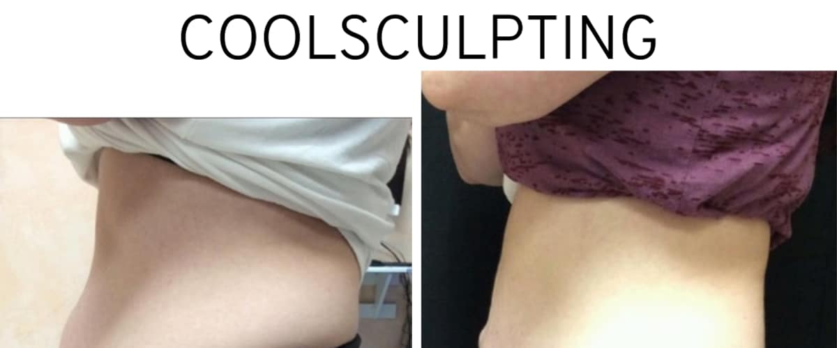 Metropolitan Dermatology - CoolSculpting Staten Island, med spa and aesthetic clinic in Staten Island