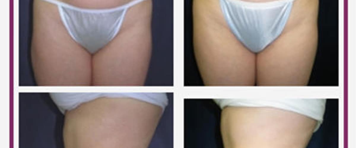 Nashua Plastic Surgery: George P. Chatson, M.D. in Manchester, New Hampshire