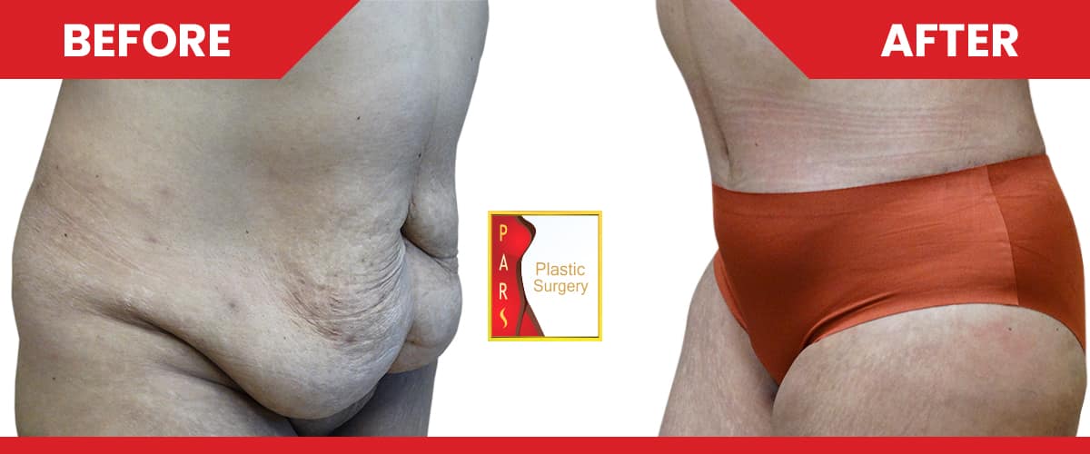 PARS Plastic Surgery in Houston, Texas
