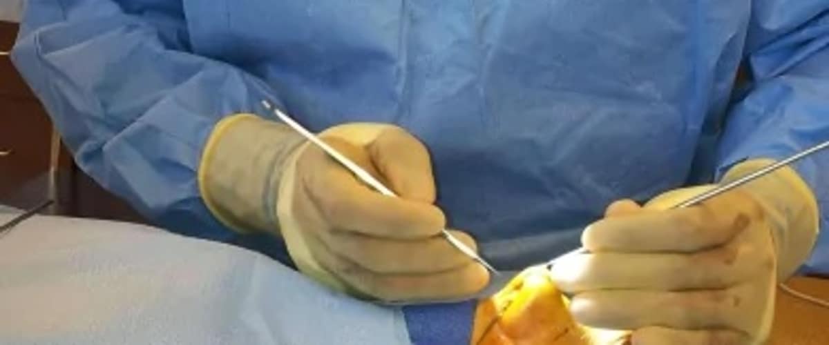 Shah Aesthetic Surgery - Rhinoplasty and Facelift Specialist in Denver, Colorado