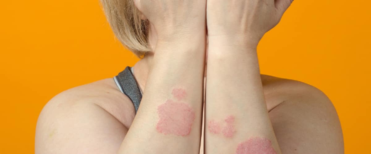 Skin Cancer Specialists in Sugar Land, Texas