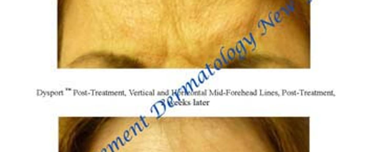 SkinProvement Dermatology New York, med spa and aesthetic clinic in New York