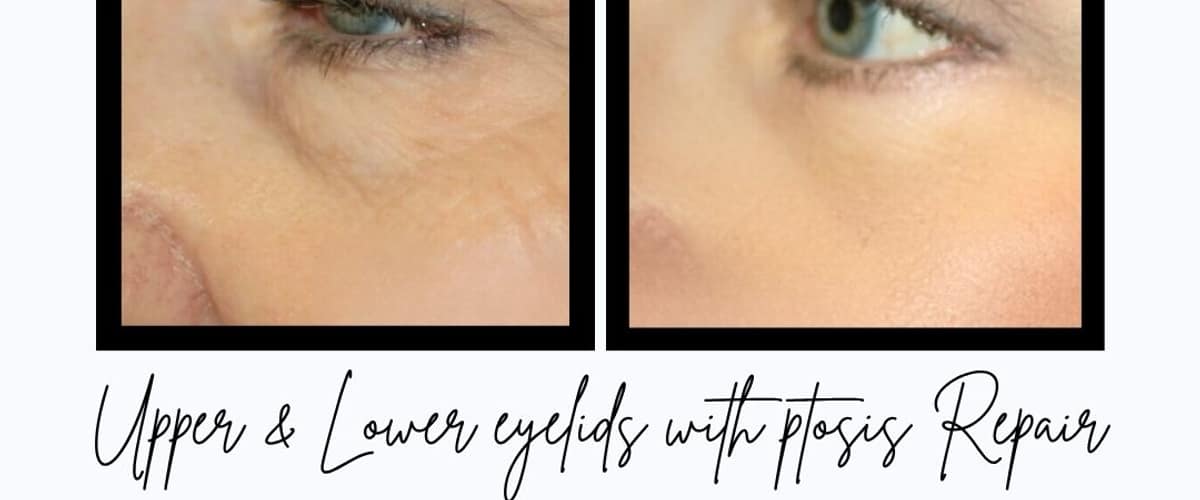 Tampa Bay Cosmetic Surgery Center in Clearwater, Florida
