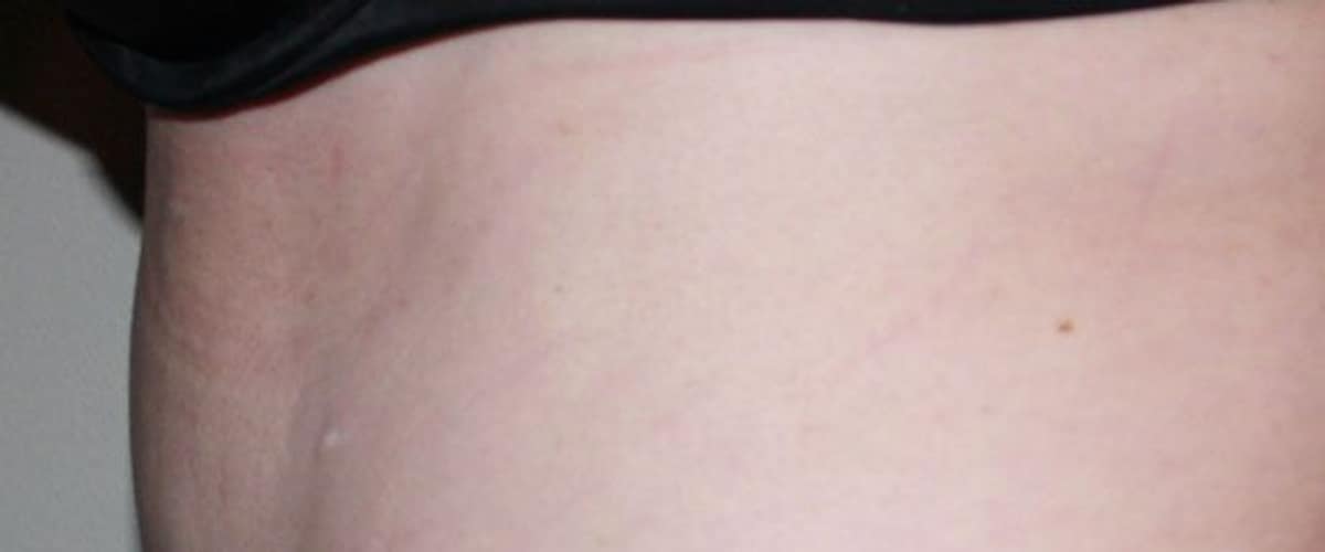 Zieg Plastic Surgery Center in Evansville, Indiana